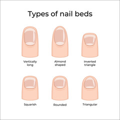 Types of nail beds -01