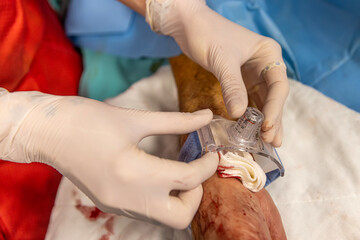 The nurse closes the vascular access of the patient after surgery. A nurse applies vascular...