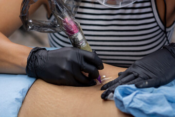 Woman tattooing stretch marks on a woman's skin