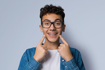 Dental dent care ad concept image - black сurly haired funny young man wear metal braces, eye glasses, show point white teeth smile. Isolated grey gray studio wall background. Positive optimistic. - obrazy, fototapety, plakaty