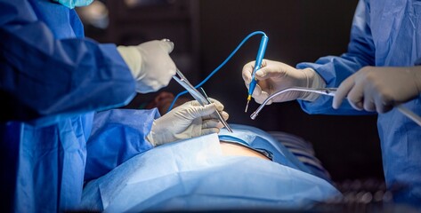 Team of surgery doctor in Operating Room, Assistant Hands out Instruments to Surgeons During...