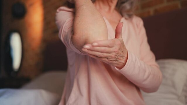 Senior woman applying ointment on dry elbow skin with psoriasis, home skincare