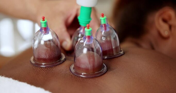 Spa, cup therapy and back of person for massage treatment, body or muscle pain with cupping. Professional therapist, client and health with vacuum for blood flow, wellness and relax or rest in resort