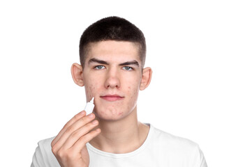 Young man with acne problem applying cosmetic product onto his skin on white background