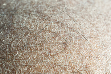 Closeup view of dry human skin .