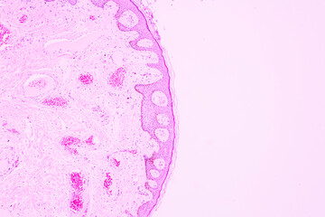 Backgrounds of human cells tissue of lung human under the microscope in pathology lab.View in...
