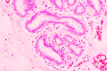 Backgrounds of human cells tissue of lung human under the microscope in pathology lab.View in...