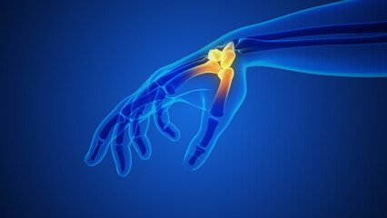 Obraz na płótnie Canvas Arthritis of the finger and thumb joint