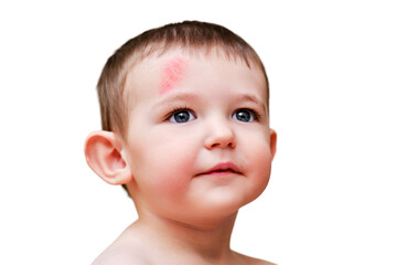 Toddler baby face with scratch on forehead, isolated on white background. Portrait of a baby boy with a head injury, isolated on white background. Kid aged one year six months