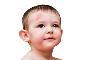 Toddler baby face with scratch on forehead, isolated on white background. Portrait of a baby boy with a head injury, isolated on white background. Kid aged one year six months