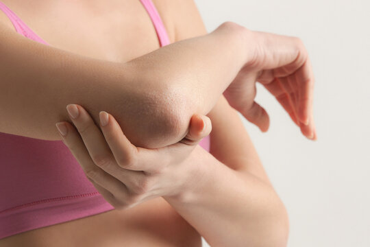 Woman showing dry itchy skin on the elbow area 