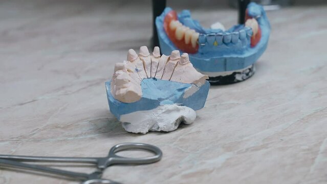 There are parts of the upper and lower parts of the denture model on the table. Background image, close-up.
