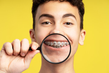 Attractive smiling teenage boy holding magnifying glass showing teeth with braces, looking at camera