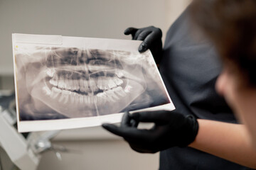 close up dental office blonde dentist in a black uniform consulting patient showing a photo of the teeth