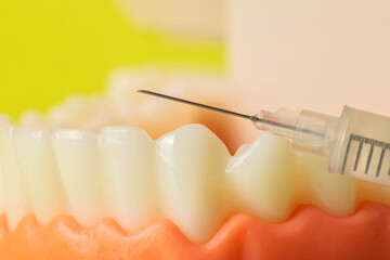 Injection of an anesthetic drug into the gum of a diseased tooth for treatment and surgery. Dental...