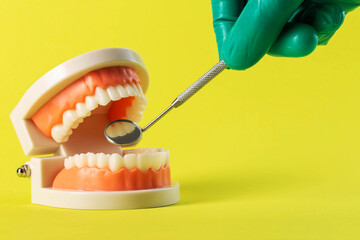 The hand of a dentist doctor in a green medical glove holds a dental mirror in his hand near a mock-up of a dental jaw on a yellow background. Concept of wisdom teeth removal, gum inflammation