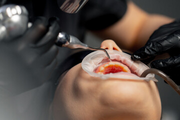 close up in a dental office female dentist in a cap is routinely cleaning the teeth of a young beautiful girl