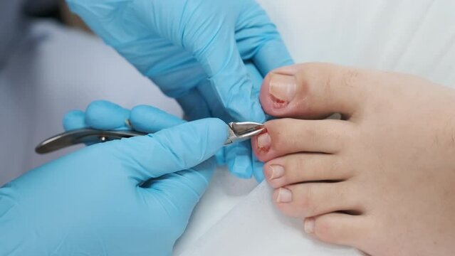 Young woman getting medical pedicure in beauty salon, close up.