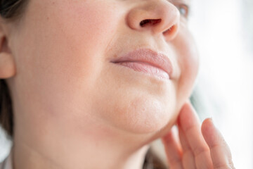 Double chin face mature woman 50 years old, human fat neck, side view, wrinkles on skin, facelift,...
