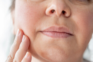 Double chin face mature woman 50 years old, human fat neck, wrinkles on skin, facelift, age-related...