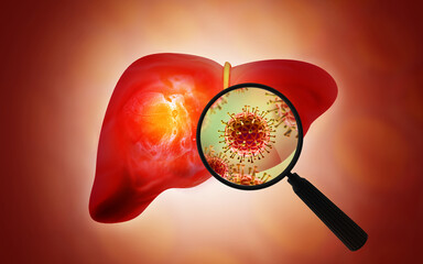Magnifying glass showing the hepatitis c virus infection. Liver disease. 3d illustration