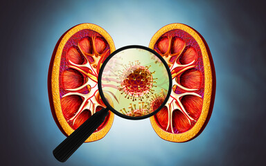 Magnifying glass showing the virus infection of kidney. Kidney disease. 3d illustration