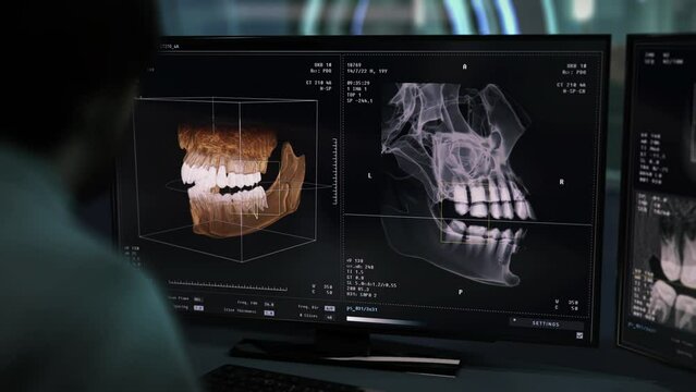 Doctor deals with examination of dental diagnostic of patient mouth cavity. Dental diagnostic system examination of a 3D skull. Dental diagnostic examination of the damaged jaw. Orthodontology.