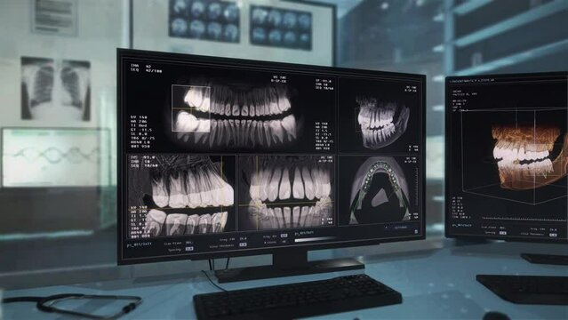 X-ray software interface examining the injured patients teeth. Medical X-ray program interface inspecting teeth in the damaged jaw. X-ray interface studying the close-up teeth images. Stomatology.