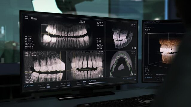 Performing imaging procedure of patient jawline at healthcare laboratory. Inspecting the Imaging of damaged teeth at healthcare laboratory. Healthcare laboratory imaging scanning equipment analysis.
