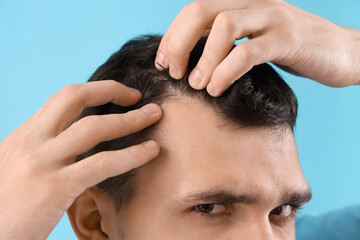 Young man with hair loss problem on blue background, closeup