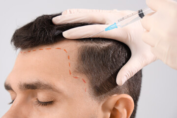 Young man with marked head receiving injection for hair growth on light background, closeup