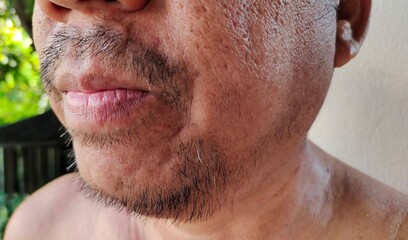 portrait of a person showing the beard, wrinkle and Flabby skin, dark spots and blemish, acne and...