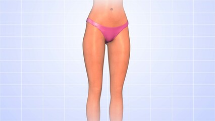 Thigh fat reduction medical animation