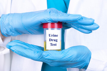 Laboratory sample of urine for drugs or substance test. Drug test is technical analysis of specimen...