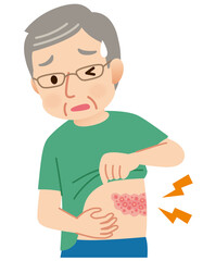 帯状疱疹ができて痛みがある高齢者男性　症状
