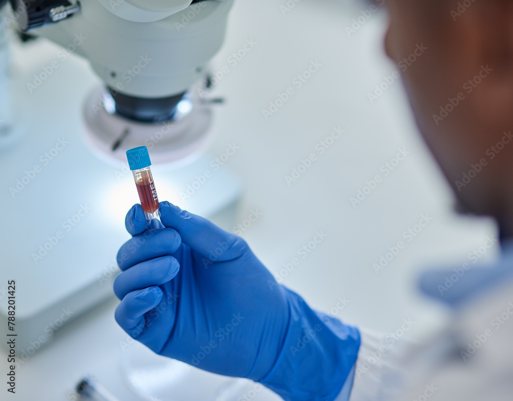 Aufkleber closeup, laboratory and man with vial, blood and testing with experiment and forensic with science. 