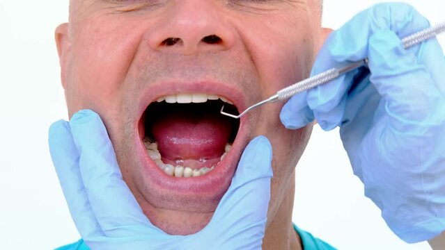 dental prosthetist examines oral cavity patient, charismatic mature man 60 years old open mouth, shows teeth with temporary fillings and metal, titanium pins for prosthetics or splinting, prosthetics