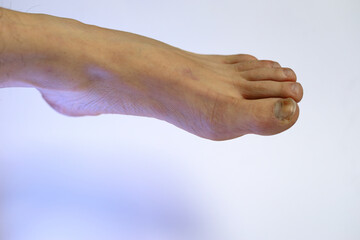  human foot closeup , isolated white background 