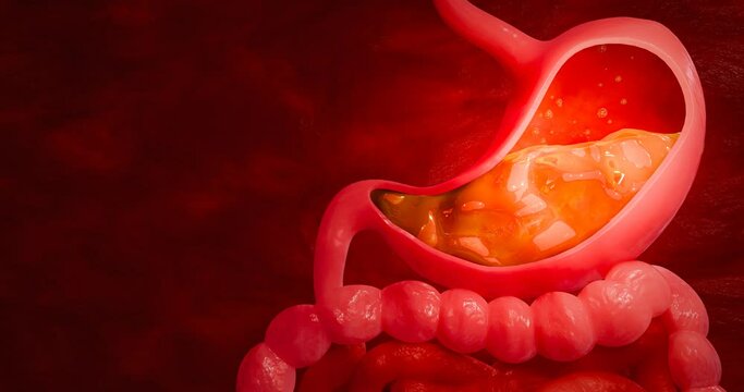 Symptoms of acid reflux or excess acid in the stomach. Gastric juice and intestinal model within the abdominal cavity. Pressure or air causes stomach pain. 3D Rendering