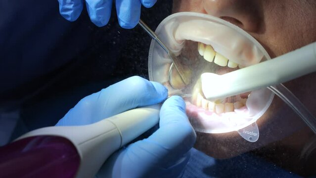Dentist Uses Water Flosser To Perform Teeth Cleaning On Female Patient Mouth Close Up