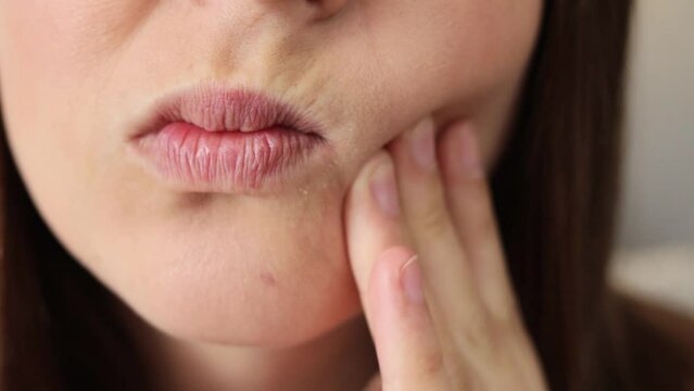 Closeup of unrecognizable miserable woman face experiencing severe toothache pressing palm to cheek feeling strong pain sensitive teeth