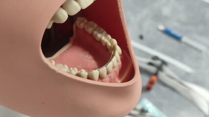 Dental mannequin for dental students with a dental splint placed on the teeth