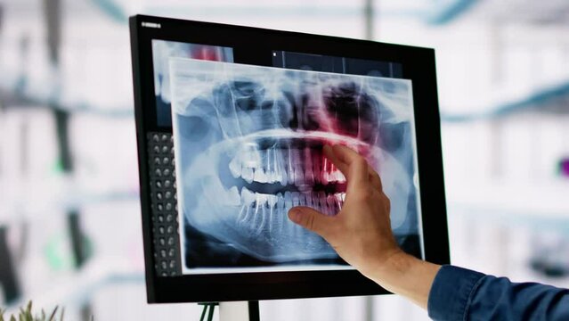 Mature Male Dentist Looking At Teeth X-ray On Computer