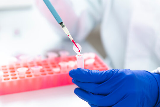 Close-up of experiment at biotech laboratory