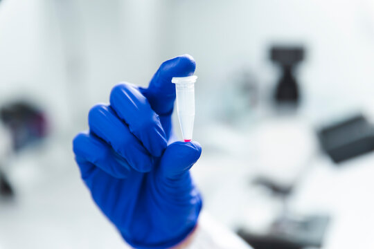 Close-up of experiment at biotech laboratory