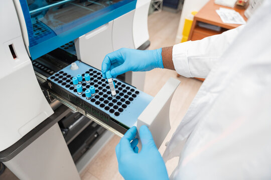 Biologist Working With Blood Samples In The Lab