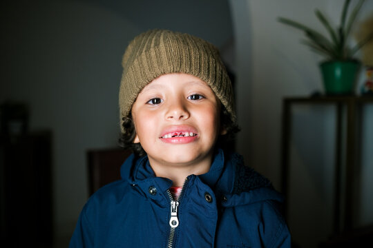 Child losing front teeth