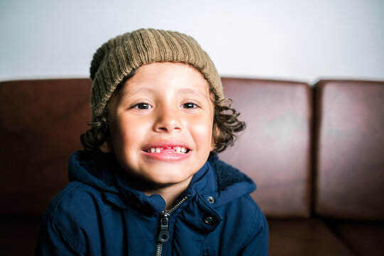 Young Boy Showing Off Teeth Missing