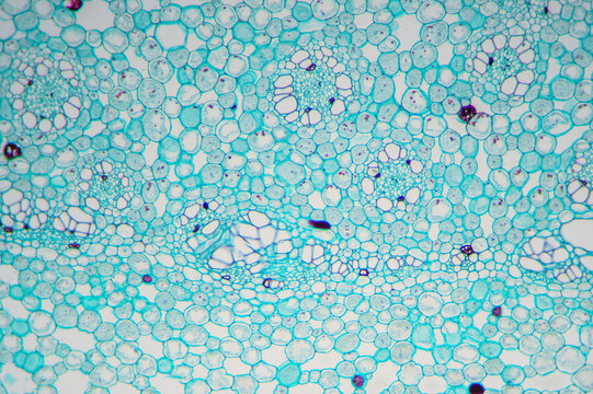 grassleaf sweelflag rhizome (Acorus gramineus) plant cells micrograph