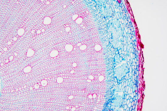 Chinese starjasmine stem plant cells micrograph